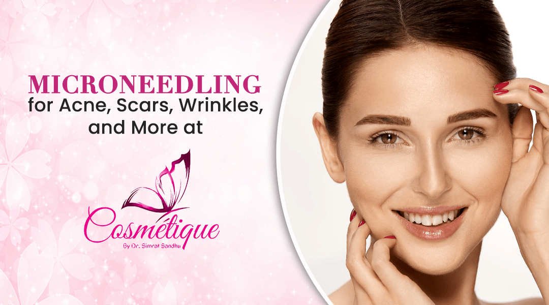 Microneedling for Acne, Scars, Wrinkles, and More at Cosmetique Clinic